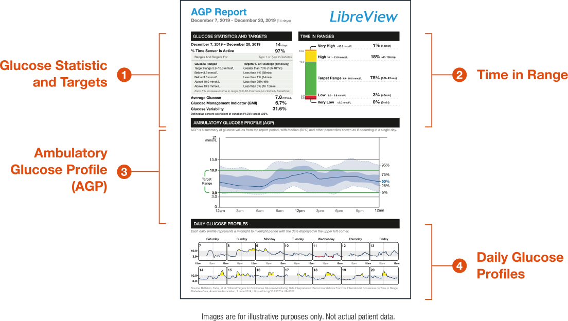 LibreView AGP Report